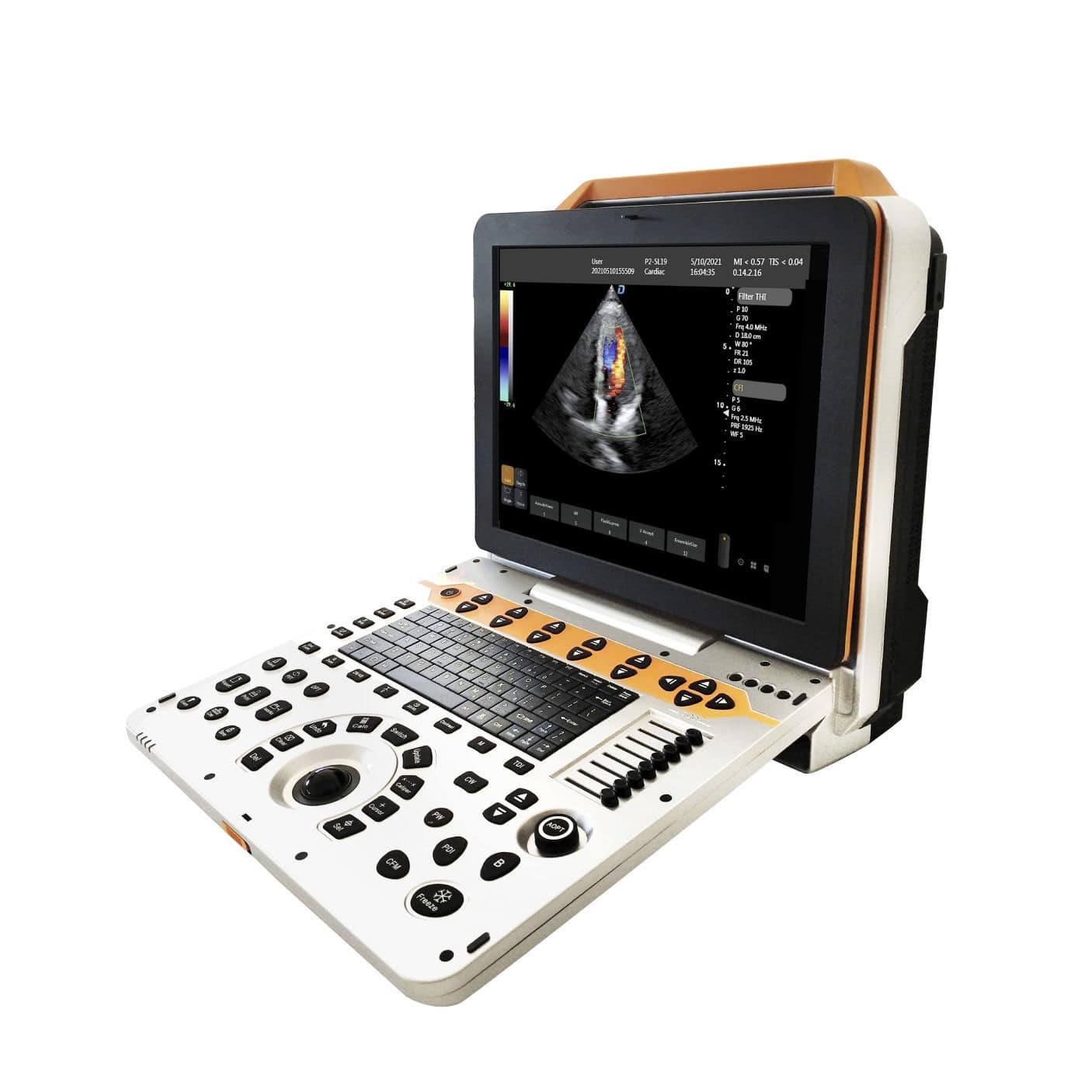 DW-P60 High quality portable ultrasound